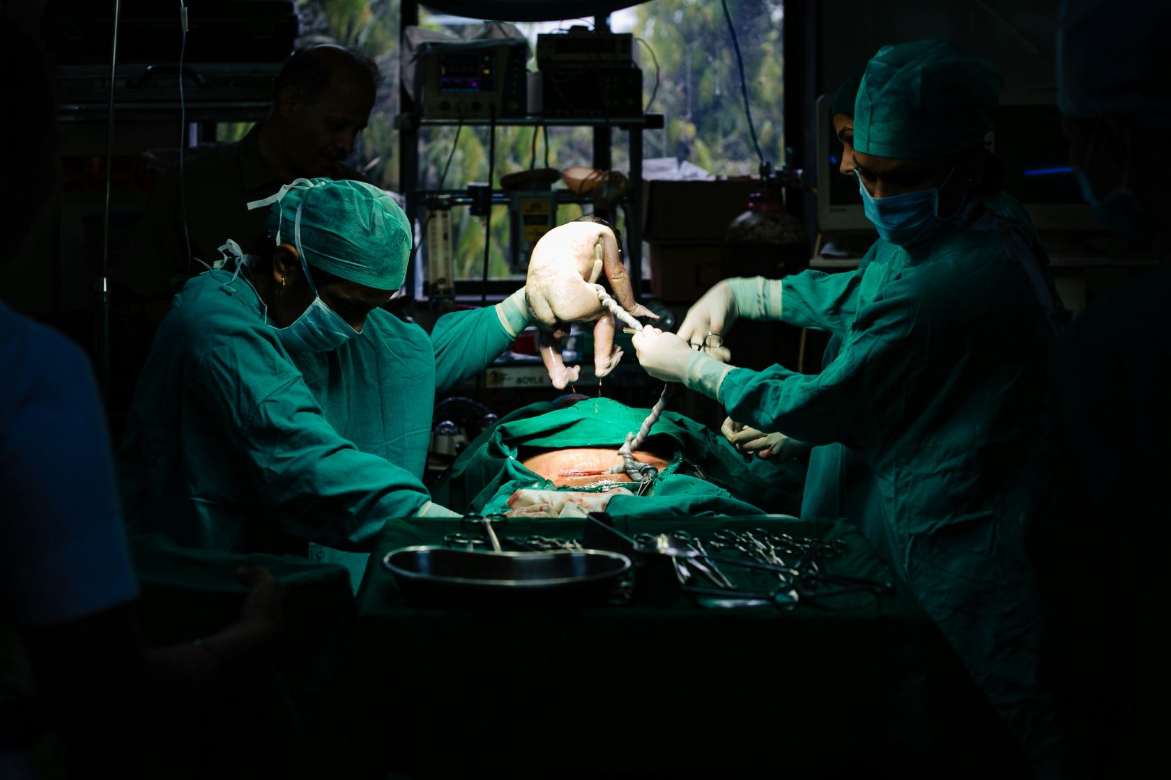The proportion of scheduled cesarean sections quadrupled last year in Portugal