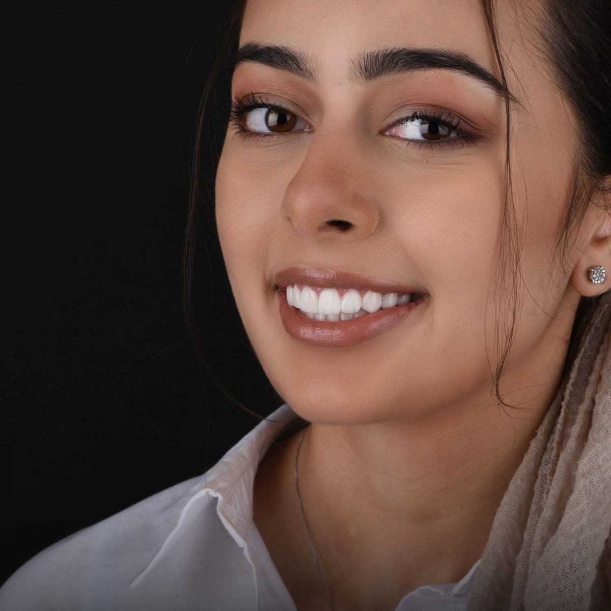 Full Veneers Cost - The Portugal News, image size:1200x1200